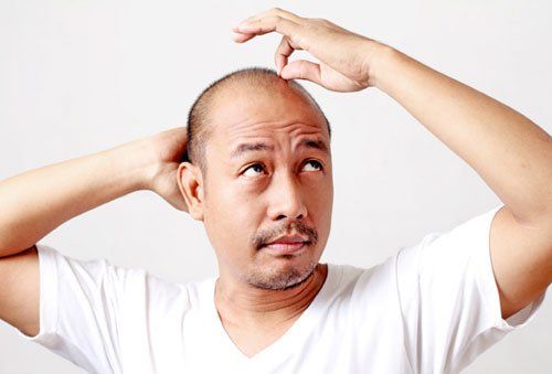 Để có được hiệu quả, bạn nên dùng Asami – trị rụng tóc, hói đầu đều đặn 2 lần đến 3 lần trên 1 tuần
