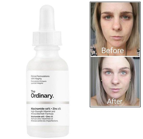 Cách sử dụng Serum The Ordinary Niacinamide 10% Zinc 1% HIỆU QUẢ