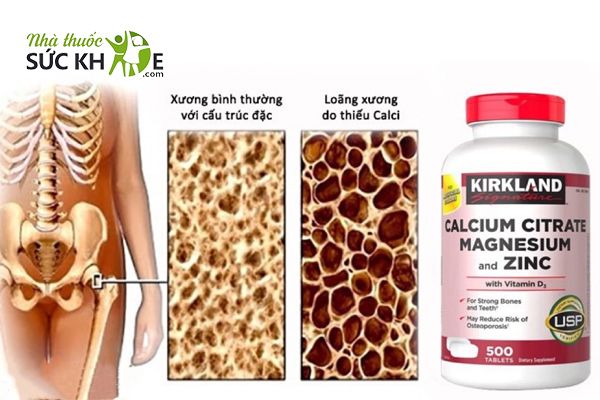 kirkland calcium citrate magnesium and zinc review