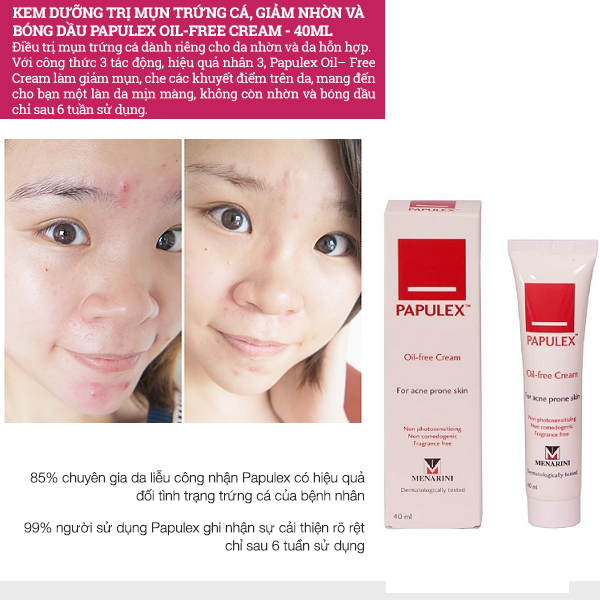 Papulex Oil Free Cream Kem Hỗ Trợ Giảm Dầu Nhờn Cải Thiện Mụn Chinh Hang Gia Tốt