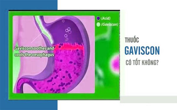 Gaviscon Action hộp 24 gói