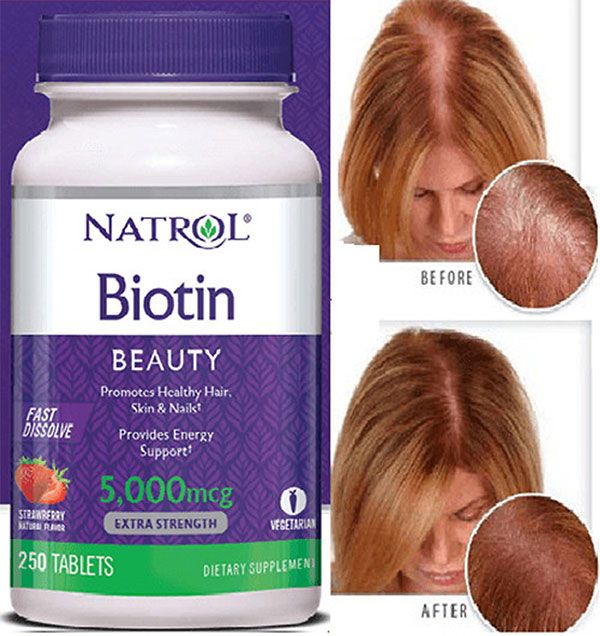 Viên ngậm mọc tóc Biotin 5000 mcg của Mỹ chính hãng