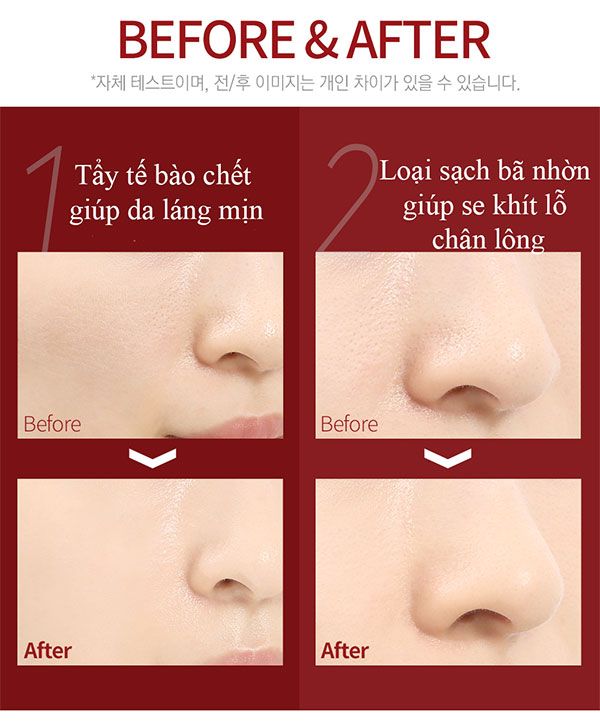 Serum Red Peel Tingle Hàn Quốc 30ml Chính Hãng