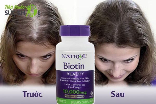 Natrol Biotin 10000 mcg viên uống hỗ trợ mọc tóc