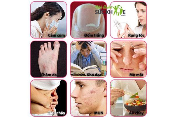 ZinC for Acne - Viên bổ sung kẽm, ngừa mụn của Mỹ