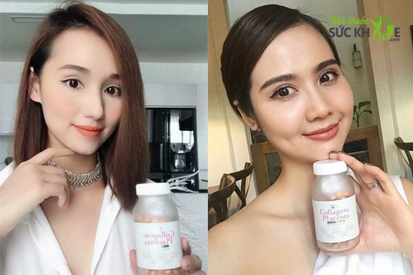 Viên Uống Collagen Placenta Chính Hãng Của Nhật Bản