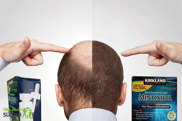 Dung dịch kích thích mọc tóc Minoxidil chính hãng từ Mỹ