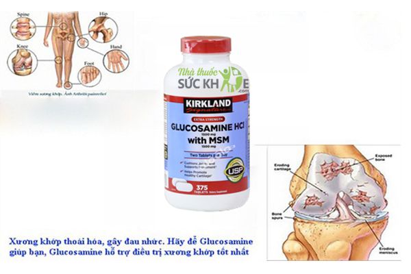 Glucosamine HCL 1500mg Kirkland With MSM 1500mg 375 Viên