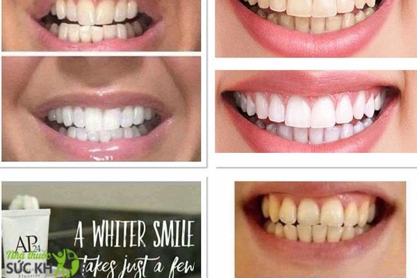 Kem Đánh Răng AP24 Hỗ Trợ Loại Bỏ Các Mảng Bám Trên Răng