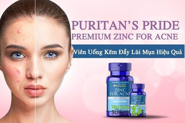 ZinC for Acne - Viên bổ sung kẽm, ngừa mụn của Mỹ
