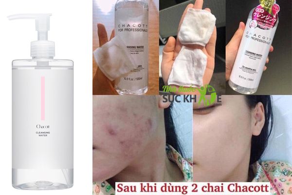 Nước tẩy trang Chacott For Professionals cho da nhạy cảm
