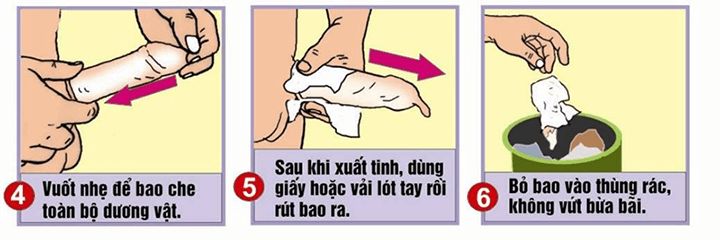 Bao cao su OLO V&agrave;ng
