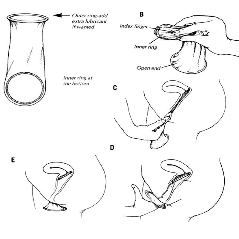 Bcs Nữ Si&ecirc;u Mỏng Female Condom - Hộp 2 Chiếc 3