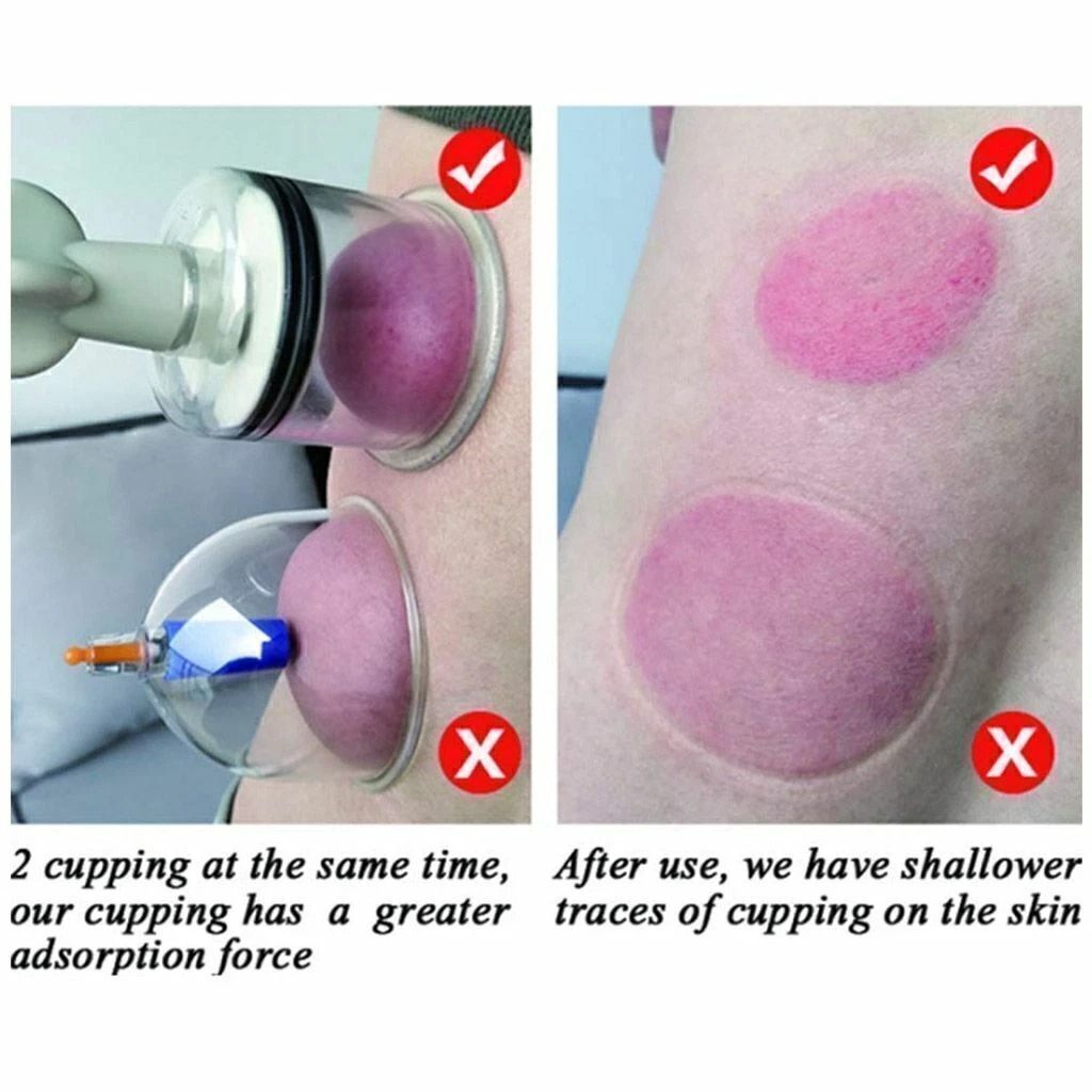 Đặt h&agrave;ng Dụng Cụ H&uacute;t N&uacute;m V&uacute; Ch&acirc;n Kh&ocirc;ng