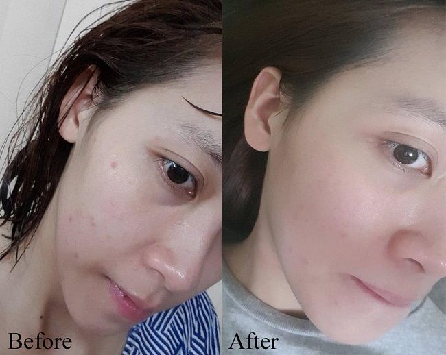 Tinh chất SVR Sebiaclear Serum hỗ trợ cải thiện mụn, mờ th&acirc;m&nbsp;