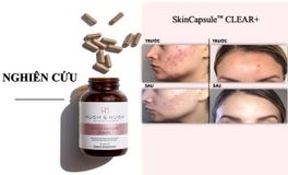Viên uống giúp giảm mụn Hush & Hush Skin Capsule Clear+