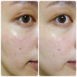 Serum nhau thai dưỡng trắng da Fracora Placenta Extract