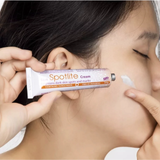 (Hàng nhập khẩu) Kem hỗ trợ mờ thâm nám Spotlite Cream