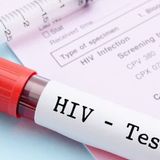 Que Tự Xét Nghiệm H.I.V Tại Nhà CheckNow - Phát Hiện Sớm Nguy Cơ Chỉ Sau 21 Ngày - Kết Quả Nhanh, Chính Xác, Dễ Dàng Sử Dụng 746257