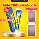 (1 Tuýp) Kem Bôi Giảm Ngứa Da Hắc Lào, Nấm Da, Viêm Da - Kem Bôi Chuyên Dụng Xuất Xứ Trung Quốc, Hàng Chính Hãng 100% 740709