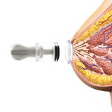 Dụng Cụ Hút Núm Vú Chân Không