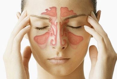 Polyp mũi: Nguyên nhân, biểu hiện, phương pháp điều trị hiệu quả