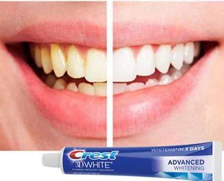 Kem đánh răng 3D Mỹ có tốt không? Giá bao nhiêu? Mua hàng ở đâu chính hãng?