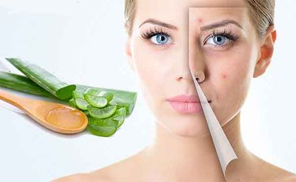 Top 9 cách trị mụn bằng nha đam hiệu quả không thể bỏ qua