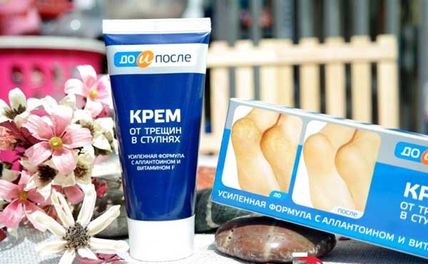 Top 15 kem trị nứt gót chân tốt nhất được bác sĩ khuyên dùng