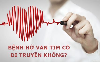 Bệnh hở van tim có di truyền không? Triệu chứng, cách điều trị và phòng ngừa?