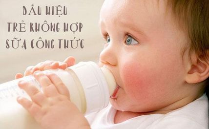 10 dấu hiệu trẻ không hợp sữa công thức mẹ cần chú ý