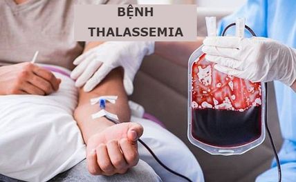 Bệnh Thalassemia là bệnh gì? Bệnh Thalassemia có chữa được không?