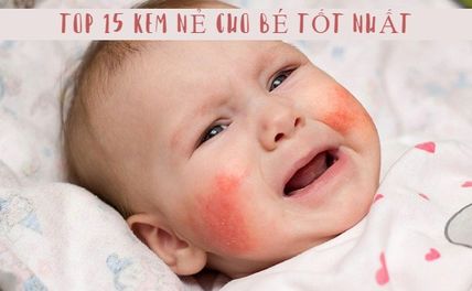 Top 15 Kem nẻ cho bé tốt nhất 2025 được nhiều mẹ tin dùng