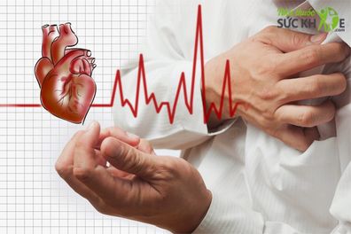 TOP 7 viên uống hỗ trợ tim mạch của Nhật tốt năm 2025
