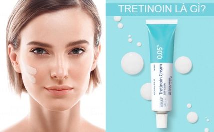 Tre là gì? Tre loại nào tốt nhất và cách sử dụng đúng chuẩn an toàn
