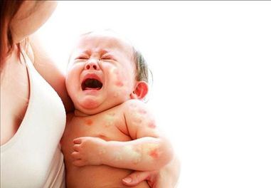 Review TOP 10 sữa cho bé bị dị ứng đạm sữa bò bán chạy