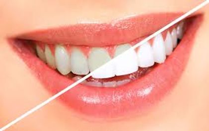 Bàn Chải Đánh Răng Điện Có Ưu Điểm Gì, Tại Sao Được Chuyên Gia Khuyên Dùng?