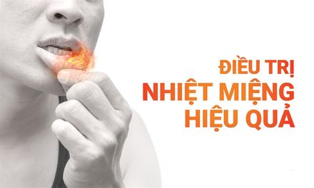 [CHUYÊN GIA KIỂM CHỨNG] Top 10+ thuốc trị nhiệt miệng NHANH - HIỆU QUẢ nhất 2025