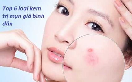 Review: Top 6 kem trị mụn tốt nhất 2025, đã kiểm chứng và chuyên gia khuyên dùng