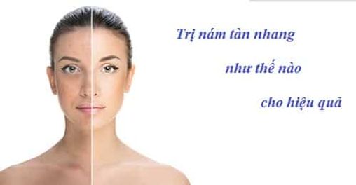 Tổng hợp những sản phẩm trị nám, tàn nhang hiệu quả - an toàn rẻ chưa đến 200k