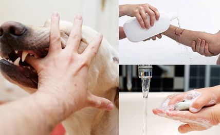 Hướng dẫn xử lý đúng cách khi bị chó cắn