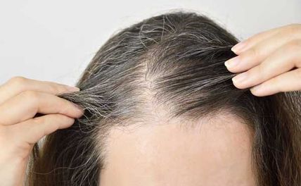 Tóc bạc sớm là do đâu? Tóc bạc sớm uống thuốc gì?