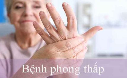 Bệnh phong thấp có nguy hiểm không: Nguyên nhân, biểu hiện và cách điều trị