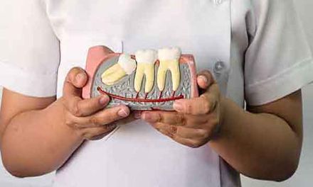 Hiểu rõ hơn về răng khôn? Nên để hay nhổ răng khôn?