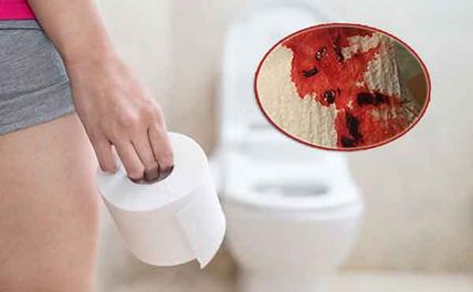 Đi ngoài ra máu là dấu hiệu bệnh gì? Nguy hiểm không? Điều trị và phòng bệnh ra sao?