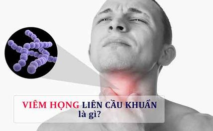 Viêm họng do liên cầu khuẩn biểu hiện như thế nào? Nguy hiểm không?