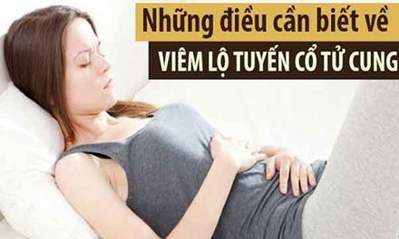 Viêm lộ tuyến cổ tử cung nguy hiểm không? Biểu hiện và cách điều trị