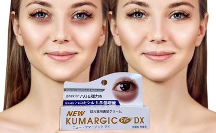 Top 7 kem trị quầng thâm mắt tốt đang được ưa chuộng 2025