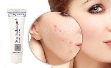 Top 15 kem trị sẹo thâm tốt nhất và cách sử dụng hiệu quả
