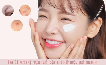 Top 11 Kem Trị Mụn Tuổi Dậy Thì Nữ Tốt Nhất Hiệu Quả Nhanh